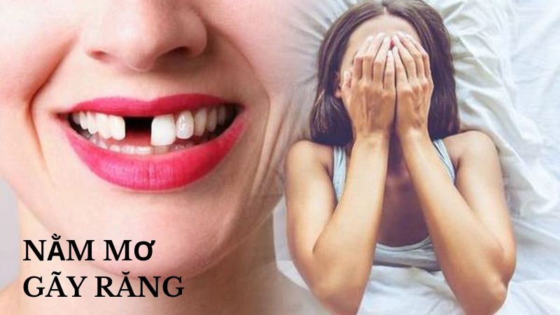 Nằm Mơ Gãy Răng: Sự Thay Đổi, Rủi Ro Hay Điềm Lành?